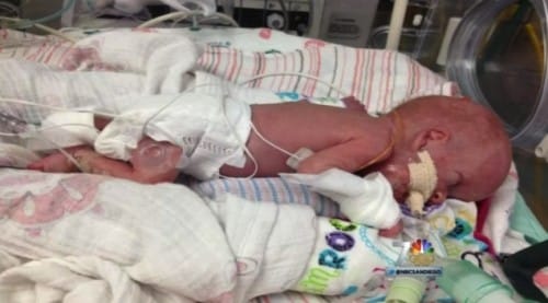 Preemie Alexis Clarke