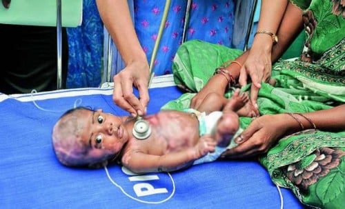 Three-month old infant Rahul