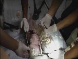 Firefighters and doctors rescue a baby by cutting away a sewage pipe piece by piece in Jinhua city