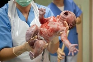 baby after being born