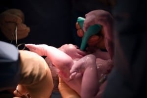 baby born via c-section
