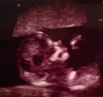 danielle jonas sonogram