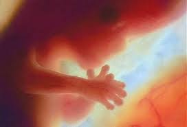 fetus 12 weeks