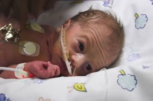 preemie