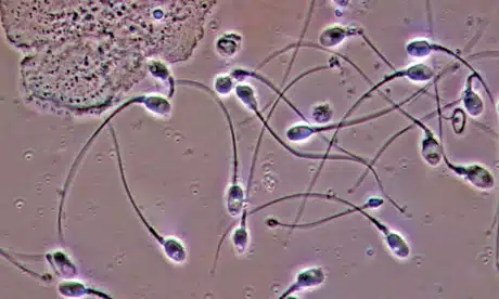 sperm