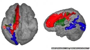 toddler brain scans