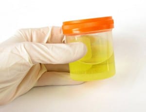 urine sample